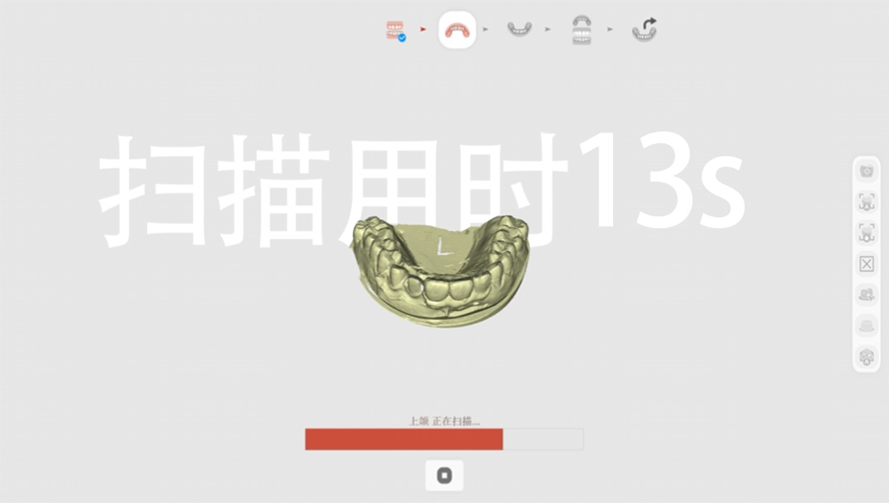 高速度